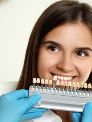 Which Endures Longer Lumineers or Veneers?