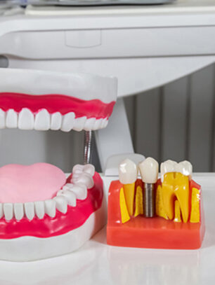 The Ultimate Solution for Tooth Restoration: Dental Crowns Near Me