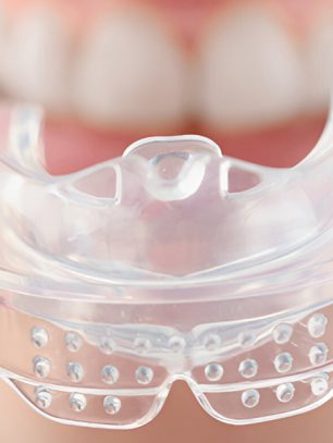 Why Mouth Guards Are Key for Jaw Health