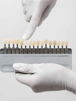 Transform Your Smile with Porcelain Veneers in Roseville