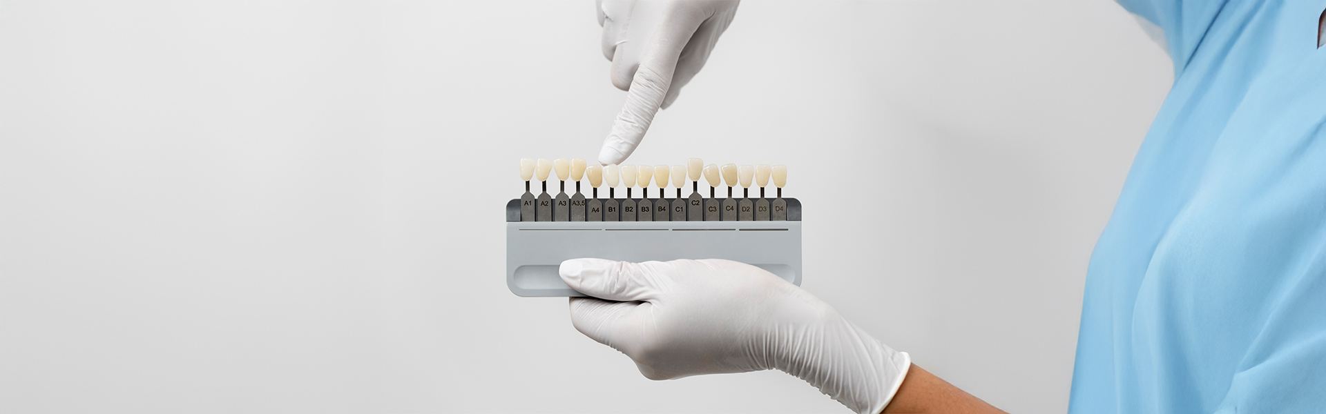 Transform Your Smile with Porcelain Veneers in Roseville