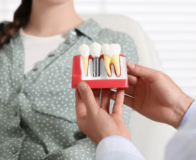 Dental Implant